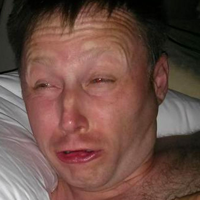 limmy